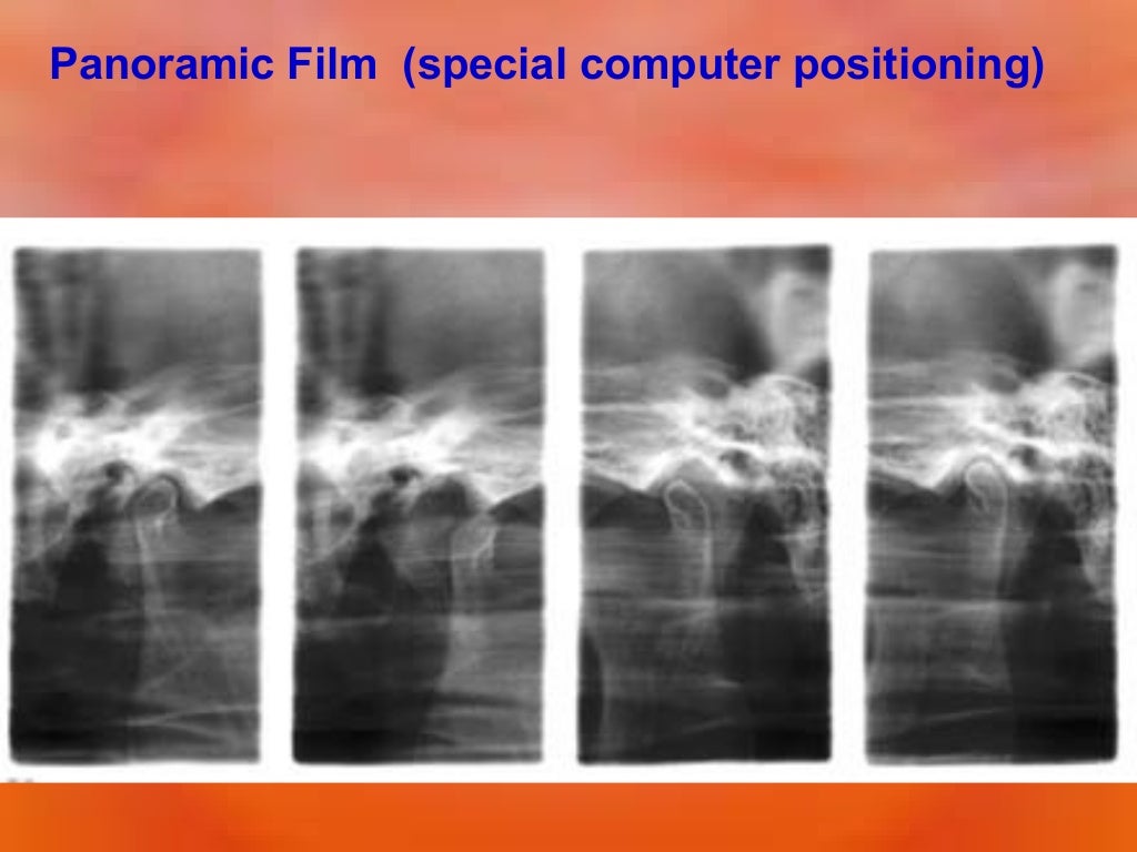 Extraoral Radiology Techniques II