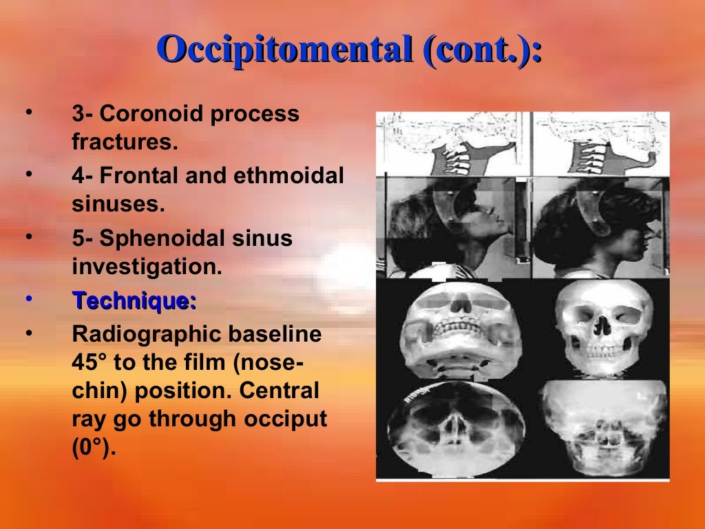 Extraoral Radiology Techniques II
