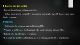 1-Lateral jaw projection
• Known also as lateral oblique projection
• It has been largely replaced by panoramic radiographs but still taken when image
details is needed.
Purpose:
• To Examine the posterior region of the mandible.
• Valuable in children, or Senile patients who can’t withstand intraoral films.
• Patients who have fractures or swelling.
• It evaluate the condition of the bone and to locate impacted teeth or large lesions.
 