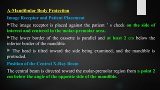 A-Mandibular Body Protection
Image Receptor and Patient Placement
The image receptor is placed against the patient ’ s cheek on the side of
interest and centered in the molar-premolar area.
The lower border of the cassette is parallel and at least 2 cm below the
inferior border of the mandible.
 The head is tilted toward the side being examined, and the mandible is
protruded.
Position of the Central X-Ray Beam
The central beam is directed toward the molar-premolar region from a point 2
cm below the angle of the opposite side of the mandible.
 