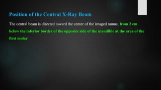 Position of the Central X-Ray Beam
The central beam is directed toward the center of the imaged ramus, from 2 cm
below the inferior border of the opposite side of the mandible at the area of the
first molar
 