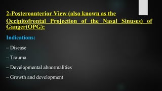 2-Posteroanterior View (also known as the
Occipitofrontal Projection of the Nasal Sinuses) of
Ganger(OPG):
Indications:
– Disease
– Trauma
– Developmental abnormalities
– Growth and development
 