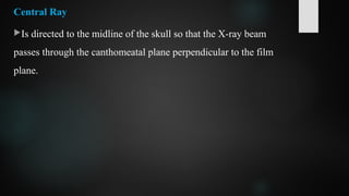 Central Ray
Is directed to the midline of the skull so that the X-ray beam
passes through the canthomeatal plane perpendicular to the film
plane.
 
