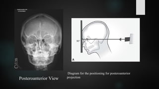 Posteroanterior View
Diagram for the positioning for posteroanterior
projection
 