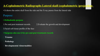 A-Cephalometric Radiographs Lateral skull (cephalometric )projection:
• It shows the entire skull from the side and the X-ray passes from the lateral side
Purpose:
• Orthodontic purpose
1.Pre and post treatment records. 2.Evaluate the growth and development
3.Facial soft tissue profile of the face
• Surgeons also use it for pre and post treatment records
 Trauma
 Pathology
 Developmental Abnormalities
 