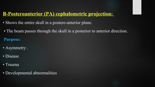 B-Posteroanterior (PA) cephalometric projection:
• Shows the entire skull in a postero-anterior plane.
• The beam passes through the skull in a posterior to anterior direction.
Purpose:
• Asymmetry .
• Disease
• Trauma
• Developmental abnormalities
 
