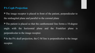 PA Ceph Projection
The image receptor is placed in front of the patient, perpendicular to
the midsagittal plane and parallel to the coronal plane
The patient is placed so that the canthomeatal line forms a 10-degree
angle with the horizontal plane and the Frankfurt plane is
perpendicular to the image receptor.
In the PA skull projection, the C-M line is perpendicular to the image
receptor.
 