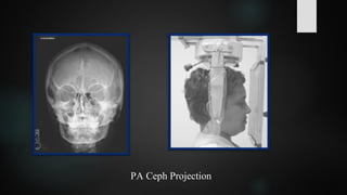 PA Ceph Projection
 