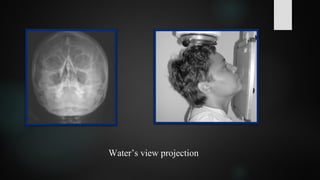 Water’s view projection
 