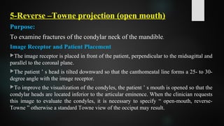 5-Reverse –Towne projection (open mouth)
Purpose:
To examine fractures of the condylar neck of the mandible.
Image Receptor and Patient Placement
The image receptor is placed in front of the patient, perpendicular to the midsagittal and
parallel to the coronal plane.
The patient ’ s head is tilted downward so that the canthomeatal line forms a 25- to 30-
degree angle with the image receptor.
To improve the visualization of the condyles, the patient ’ s mouth is opened so that the
condylar heads are located inferior to the articular eminence. When the clinician requests
this image to evaluate the condyles, it is necessary to specify “ open-mouth, reverse-
Towne ” otherwise a standard Towne view of the occiput may result.
 