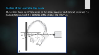 Position of the Central X-Ray Beam
The central beam is perpendicular to the image receptor and parallel to patient ’ s
midsagittal plane and it is centered at the level of the condyles.
 