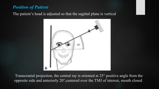 Position of Patient
The patient’s head is adjusted so that the sagittal plane is vertical
Transcranial projection, the central ray is oriented at 25° positive angle from the
opposite side and anteriorly 20°,centered over the TMJ of interest, mouth closed
 