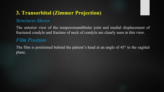 3. Transorbital (Zimmer Projection)
Structures Shown
The anterior view of the temporomandibular joint and medial displacement of
fractured condyle and fracture of neck of condyle are clearly seen in this view.
Film Position
The film is positioned behind the patient’s head at an angle of 45° to the sagittal
plane.
 
