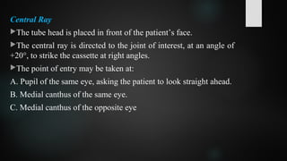 Central Ray
The tube head is placed in front of the patient’s face.
The central ray is directed to the joint of interest, at an angle of
+20°, to strike the cassette at right angles.
The point of entry may be taken at:
A. Pupil of the same eye, asking the patient to look straight ahead.
B. Medial canthus of the same eye.
C. Medial canthus of the opposite eye
 