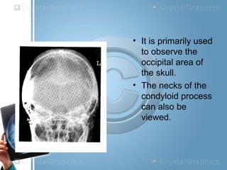 • It is primarily used
to observe the
occipital area of
the skull.
• The necks of the
condyloid process
can also be
viewed.
 