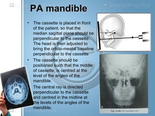 PA mandiblePA mandible
• The cassette is placed in front
of the patient, so that the
median sagittal plane should be
perpendicular to the cassette.
The head is then adjusted to
bring the orbito-meatal baseline
perpendicular to the cassette
• The cassette should be
positioned such that the middle
of cassette, is centred at the
level of the angles of the
mandible.
• The central ray is directed
perpendicular to the cassette
and centred in the midline at
the levels of the angles of the
mandible.
 