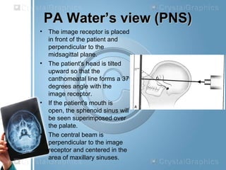 PA Water’s view (PNS)PA Water’s view (PNS)
• The image receptor is placed
in front of the patient and
perpendicular to the
midsagittal plane.
• The patient's head is tilted
upward so that the
canthomeatal line forms a 37
degrees angle with the
image receptor.
• If the patient's mouth is
open, the sphenoid sinus will
be seen superimposed over
the palate.
• The central beam is
perpendicular to the image
receptor and centered in the
area of maxillary sinuses.
 