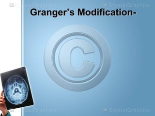 Granger’s Modification-Granger’s Modification-
 