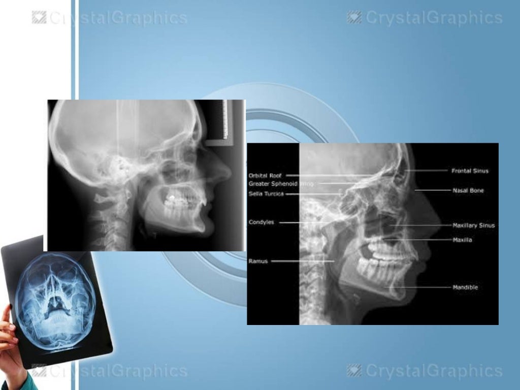 Extraoral radiography