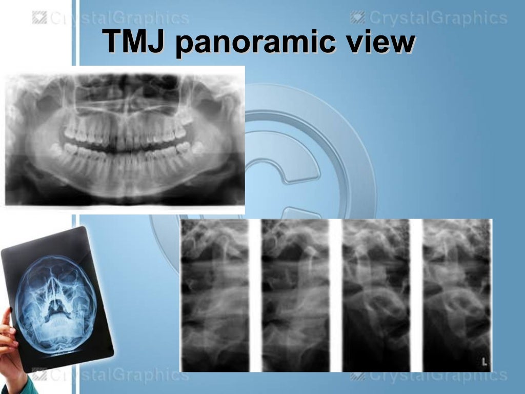Extraoral radiography