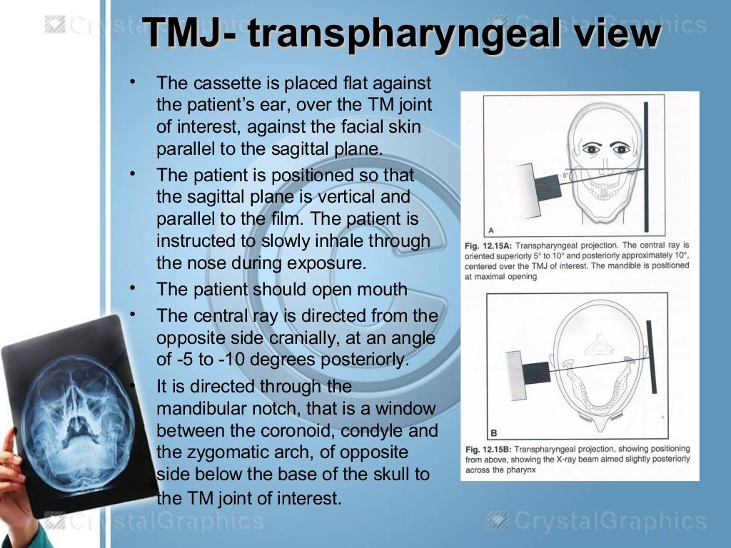 Extraoral radiography