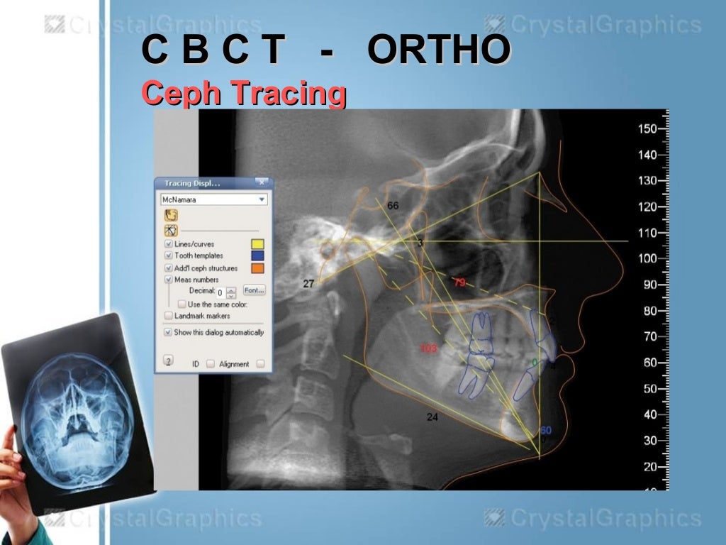 Extraoral radiography