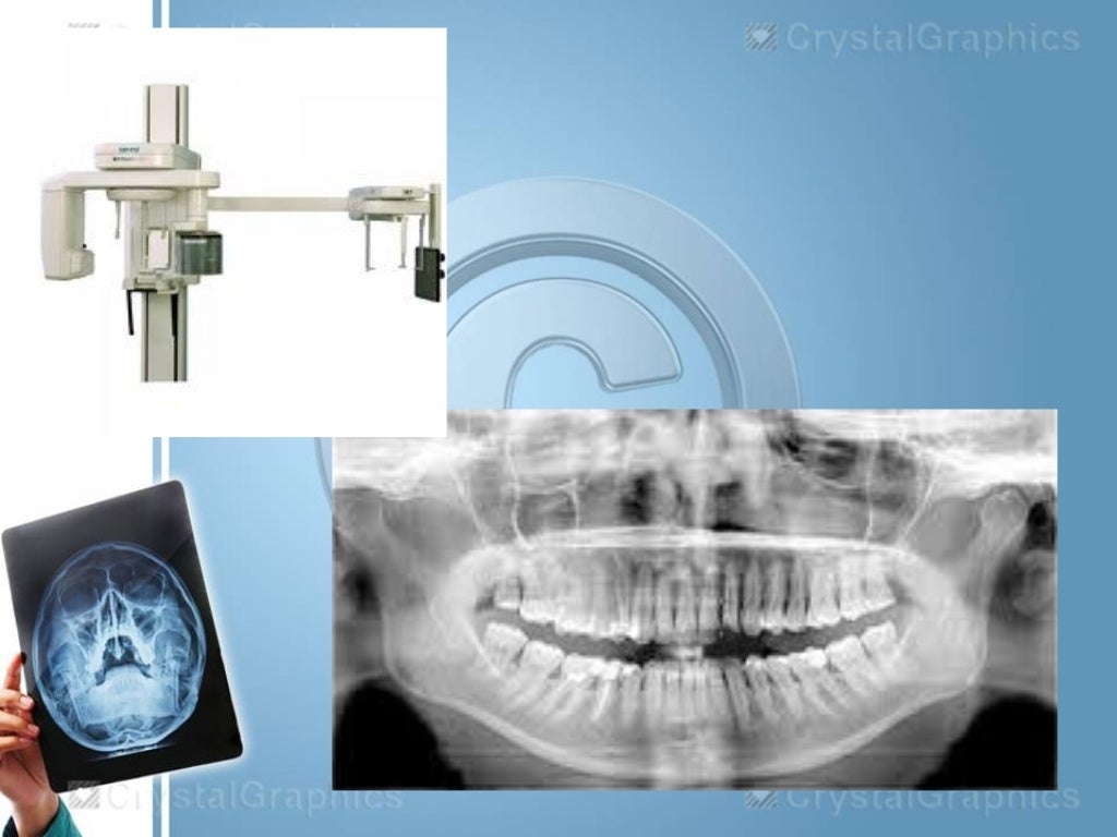 Extraoral radiography