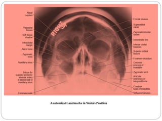 Positioning Landmarks Radiography Extra-oral Radiographic Techniques | PPTX