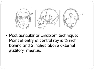 Extra-oral Radiographic Techniques | PPTX