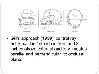 Extra-oral Radiographic Techniques | PPTX