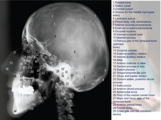 Coronal Process On Radiograph OMRD extraoral radiography-final (1).pptx