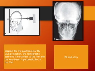 EXTRA ORAL RADIOGRAPHY | PPTX