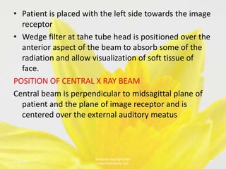 • Patient is placed with the left side towards the image
  receptor
• Wedge filter at tahe tube head is positioned over the
  anterior aspect of the beam to absorb some of the
  radiation and allow visualization of soft tissue of
  face.
POSITION OF CENTRAL X RAY BEAM
Central beam is perpendicular to midsagittal plane of
  patient and the plane of image receptor and is
  centered over the external auditory meatus



                       Template copyright 2005
1/23/2013                                              16
                        www.brainybetty.com
 