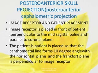 POSTEROANTERIOR SKULL
            PROJECTION(posteroanterior
             cephalometric projection
• IMAGE RECEPTOR AND PATIENT PLACEMENT
• Image receptor is placed in front of patient
  ,perpendicular to the mid sagittal palne and
  parallel to coronal plane
• The patient is patient is placed so that the
  canthomeatal line forms 10 degree anglewith
  the horizontal plane and the frankfort plane
  is perpendicular to image receptor
                     Template copyright 2005
1/23/2013                                        26
                      www.brainybetty.com
 