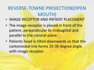 REVERSE-TOWNE PROJECTION(OPEN
              MOUTH)
• IMAGE RECEPTOR AND PATIENT PLACEMENT
• The image receptor is placed in front of the
  patient, perpandicular to midsagittal and
  parallel to the coronal plane .
• Patients head is tilted downwards so that the
  cantomeatal line forms 25-30 degree angle
  with image receptor.


                    Template copyright 2005
1/23/2013                                         29
                     www.brainybetty.com
 