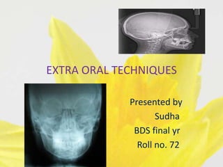 EXTRA ORAL TECHNIQUES

             Presented by
                    Sudha
              BDS final yr
               Roll no. 72
 