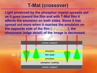T-Mat (crossover)
Light produced by the phosphor crystal spreads out
as it goes toward the film and with T-Mat film it
affects the emulsion on both sides. Since it has
spread out more when it reaches the emulsion on
the opposite side of the film (crossover), the
crossover
sharpness (edge detail) of the image is decreased.

film

 
