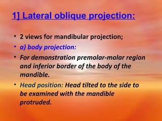 1] Lateral oblique projection:
• 2 views for mandibular projection;
• a) body projection:
• For demonstration premolar-molar region
and inferior border of the body of the
mandible.
• Head position: Head tilted to the side to
be examined with the mandible
protruded.

 
