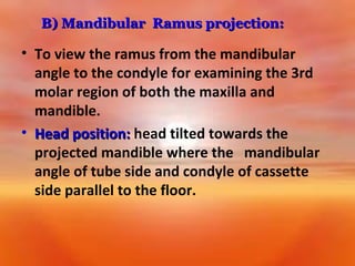 B) Mandibular Ramus projection:

• To view the ramus from the mandibular
angle to the condyle for examining the 3rd
molar region of both the maxilla and
mandible.
• Head position: head tilted towards the
projected mandible where the mandibular
angle of tube side and condyle of cassette
side parallel to the floor.

 