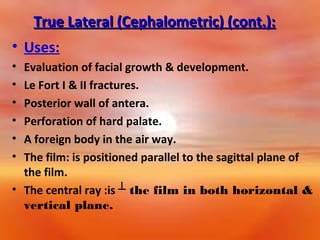 True Lateral (Cephalometric) (cont.):
• Uses:
•
•
•
•
•
•

Evaluation of facial growth & development.
Le Fort I & II fractures.
Posterior wall of antera.
Perforation of hard palate.
A foreign body in the air way.
The film: is positioned parallel to the sagittal plane of
the film.
• The central ray :is ┴ the film in both horizontal &
vertical plane.

 