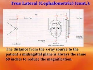 True Lateral (Cephalometric) (cont.):

The distance from the x-ray source to the
patient’s midsagittal plane is always the same
60 inches to reduce the magnification.

 