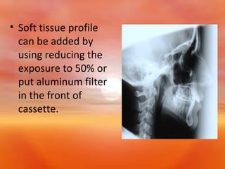 • Soft tissue profile
can be added by
using reducing the
exposure to 50% or
put aluminum filter
in the front of
cassette.

 