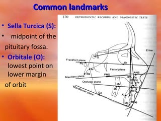 Common landmarks
• Sella Turcica (S):
• midpoint of the
pituitary fossa.
• Orbitale (O):
lowest point on
lower margin
of orbit

 