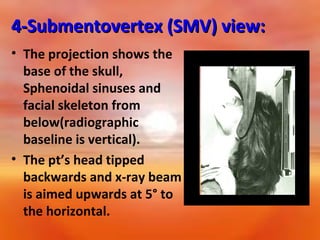 4-Submentovertex (SMV) view:
• The projection shows the
base of the skull,
Sphenoidal sinuses and
facial skeleton from
below(radiographic
baseline is vertical).
• The pt’s head tipped
backwards and x-ray beam
is aimed upwards at 5° to
the horizontal.

 