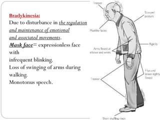 Bradykinesia:
Due to disturbance in the regulation
and maintenance of emotional
and associated movements.
Mask face= expressionless face
with
infrequent blinking.
Loss of swinging of arms during
walking.
Monotonus speech.
 