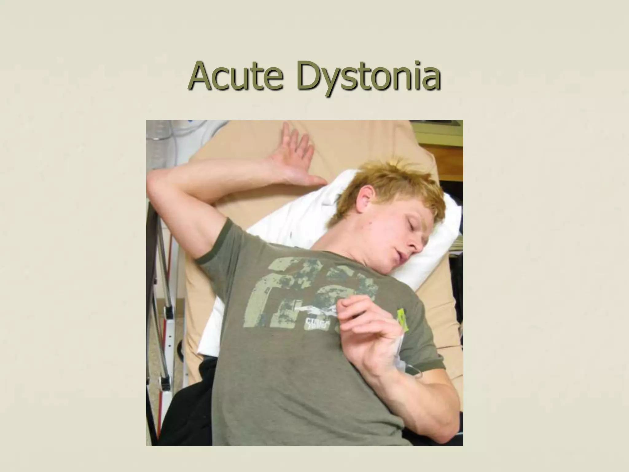 Acute Dystonia
 