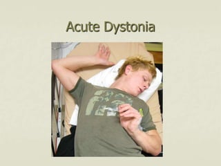 Acute Dystonia
 