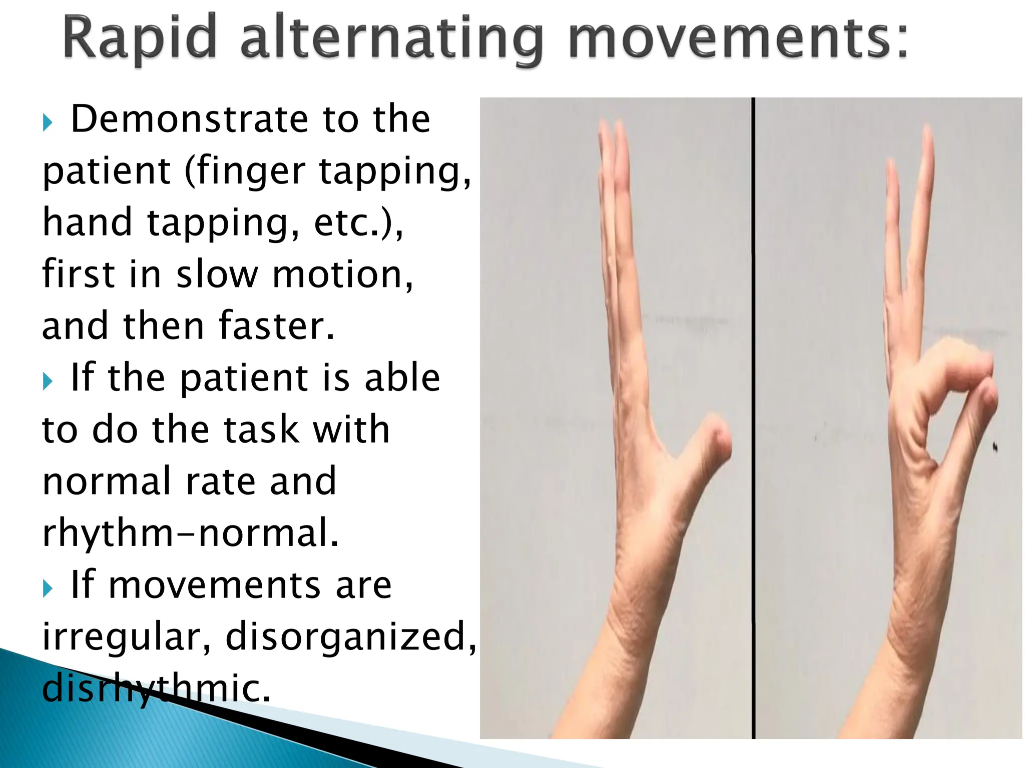  Demonstrate to the
patient (finger tapping,
hand tapping, etc.),
first in slow motion,
and then faster.
 If the patient is able
to do the task with
normal rate and
rhythm-normal.
 If movements are
irregular, disorganized,
disrhythmic.
 