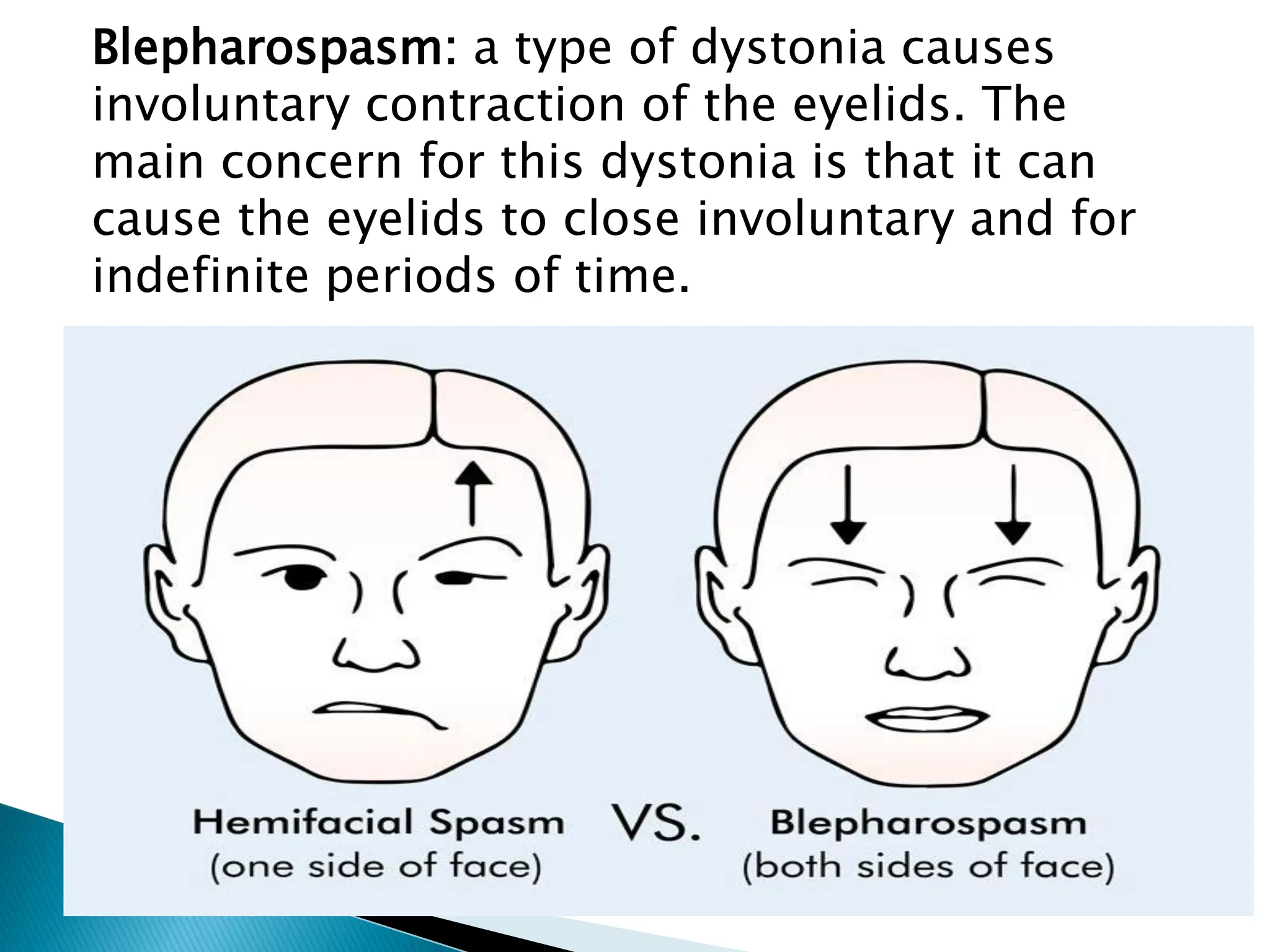 Blepharospasm: a type of dystonia causes
involuntary contraction of the eyelids. The
main concern for this dystonia is that it can
cause the eyelids to close involuntary and for
indefinite periods of time.
 
