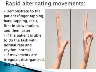  Demonstrate to the
patient (finger tapping,
hand tapping, etc.),
first in slow motion,
and then faster.
 If the patient is able
to do the task with
normal rate and
rhythm-normal.
 If movements are
irregular, disorganized,
disrhythmic.
 